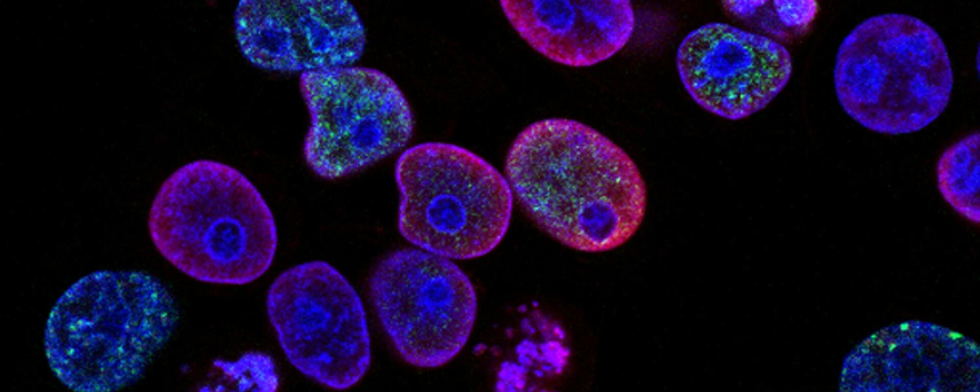Cancer cells biology